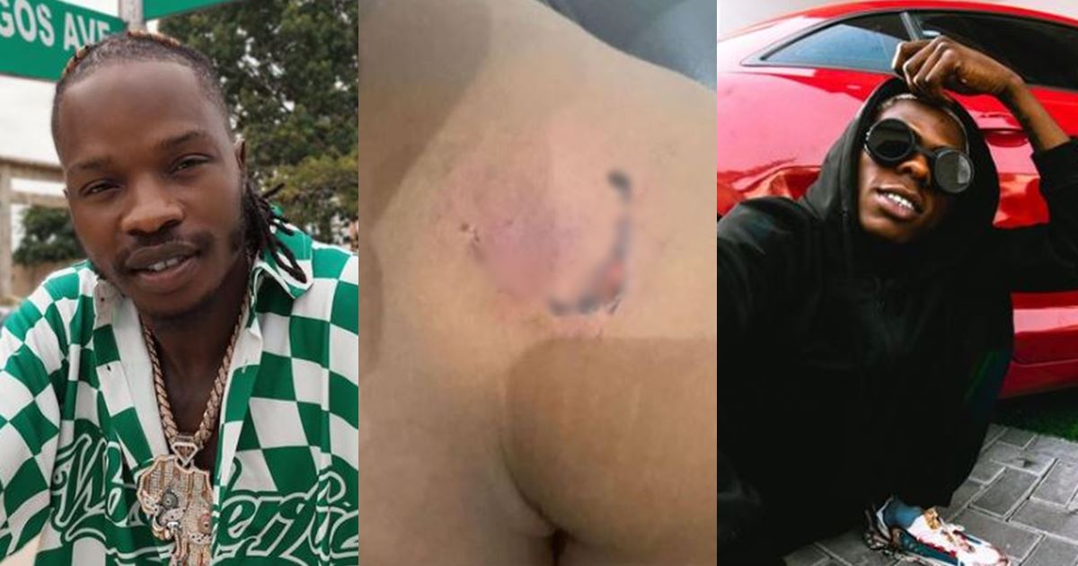 He's talking rubbish - Naira Marley's brother breaks silence, shows off injury from Mohbad's bite (Video)