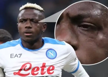 Osimhen’s June revelation: Metal in my face, wounds in my heart, and a future uncertain