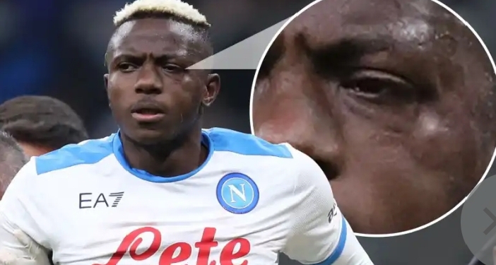 Osimhen’s June revelation: Metal in my face, wounds in my heart, and a future uncertain