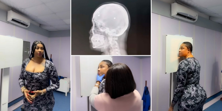 Doctors found more bullet fragments in my head – Angela Okorie reveals from hospital