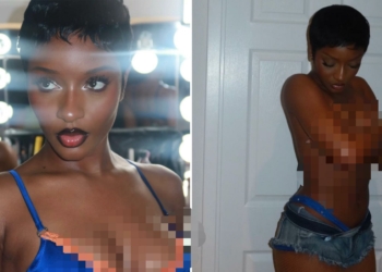 “Hands down pls” – fans quip as Ayra Starr goes topless in bold shoot