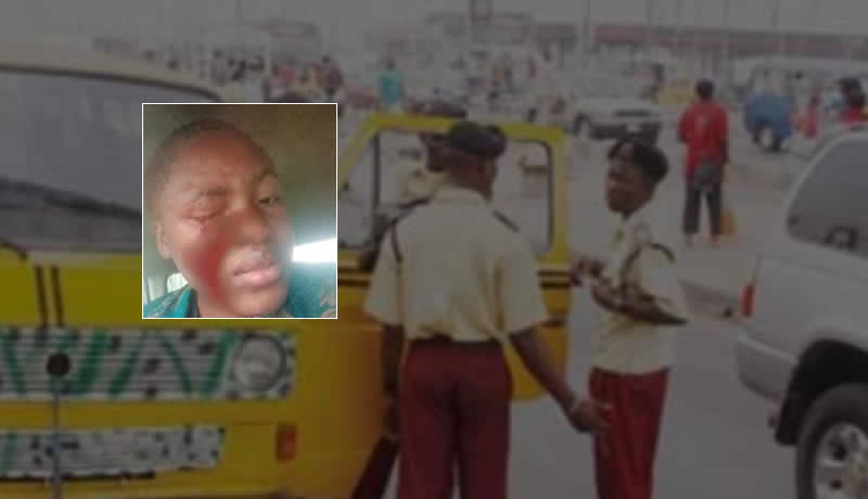 LASTMA reacts after their official reportedly beats woman until she bleeds from the eye