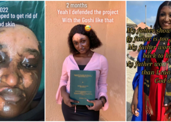 Pharmacy graduate shares her inspiring journey to recovery