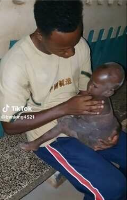 Man melts hearts as he shares the transformation of the baby he rescued from the roadside