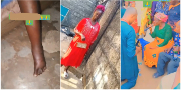 Mother's leg swells mysteriously after attending daughter’s traditional wedding