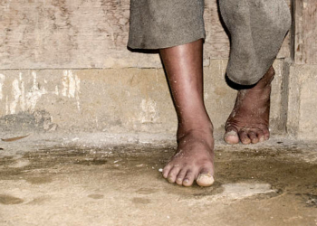 A child's bare feet on soiled ground