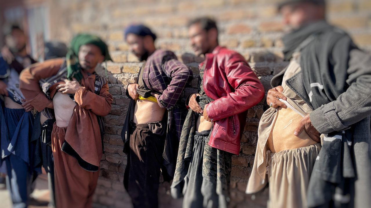 Afghans forced to sell Kidneys to survive under Taliban rule