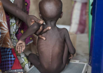 FG Moves To Tackle Malnutrition