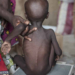 FG Moves To Tackle Malnutrition