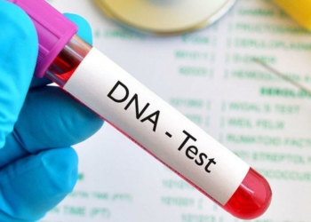 Cost of DNA Test in Nigeria