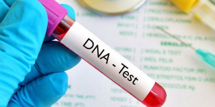 Cost of DNA Test in Nigeria