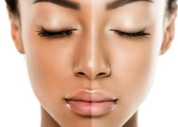 Lightening Cream for Dark Skin without Hydroquinone