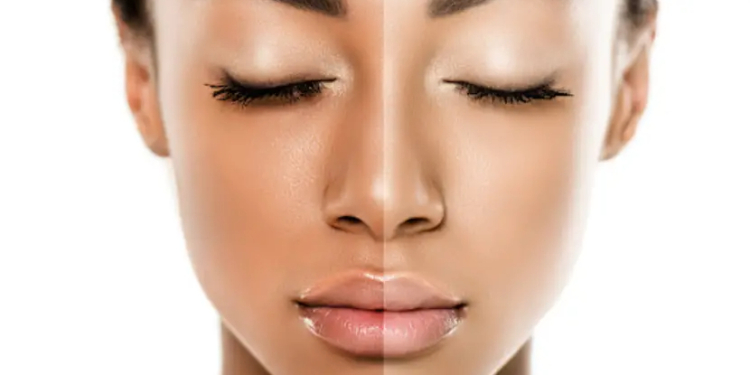 Lightening Cream for Dark Skin without Hydroquinone