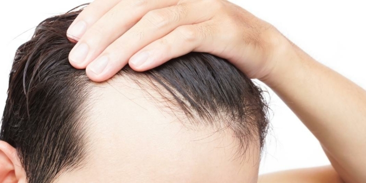 How to Naturally Thicken Your Hair