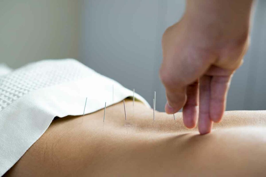 How To Become an Acupuncturist