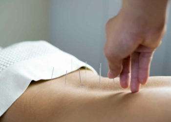 How To Become an Acupuncturist