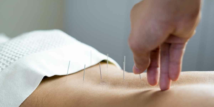 How To Become an Acupuncturist