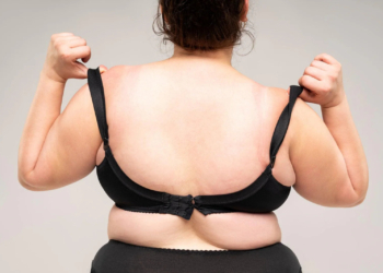 How to Get Rid of Back Fat