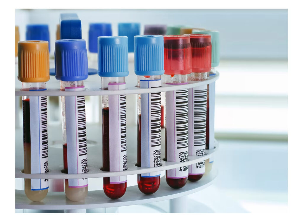 Test Tube Uses in the Laboratory