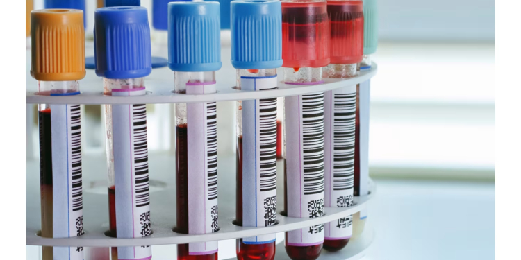 Test Tube Uses in the Laboratory