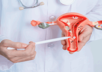 Which Size of Fibroid is Dangerous?