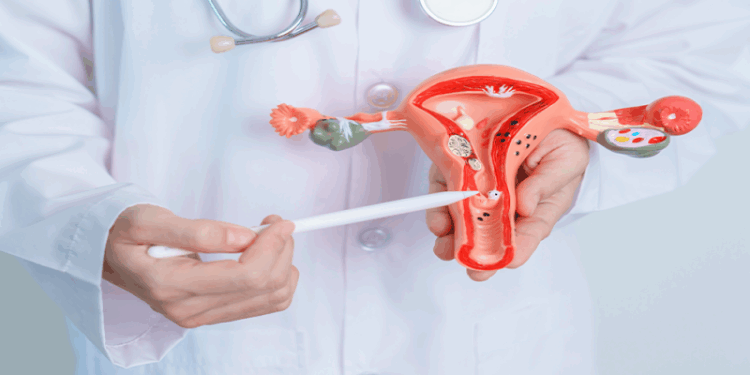 Which Size of Fibroid is Dangerous?