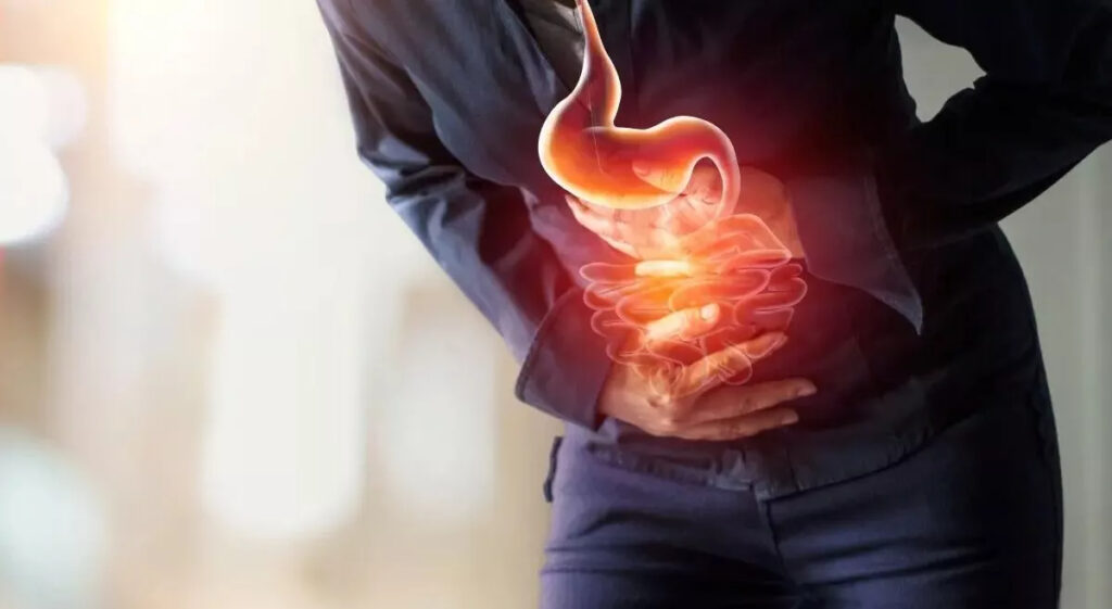 Ways to Prevent Acid Reflux and Heartburn