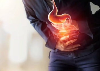 Ways to Prevent Acid Reflux and Heartburn