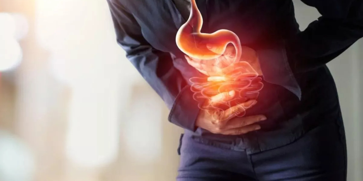 Ways to Prevent Acid Reflux and Heartburn