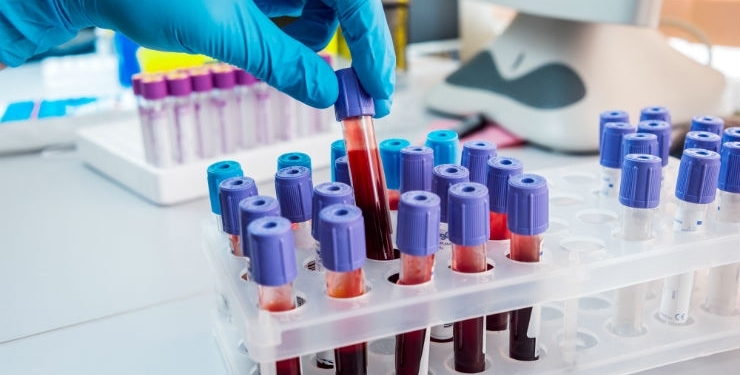 What is Chemical Pathology?