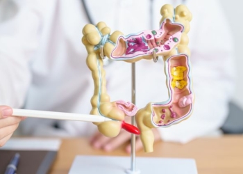 Stages of Appendicitis