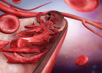Facts about AC Genotype