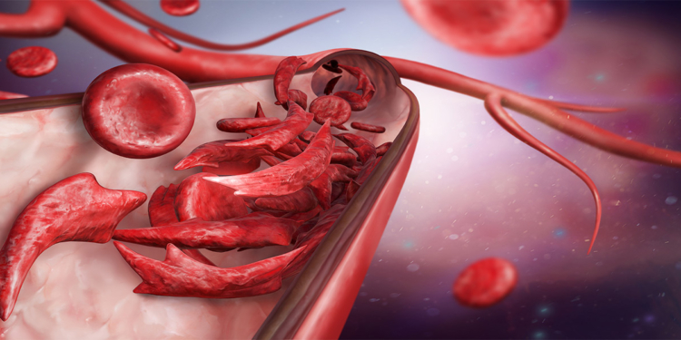Facts about AC Genotype