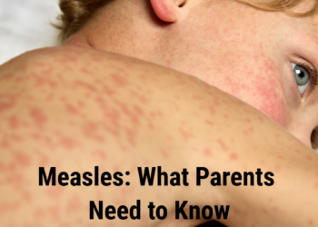 Measles: