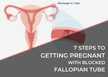 7 Steps to Getting Pregnant with Blocked Fallopian Tube