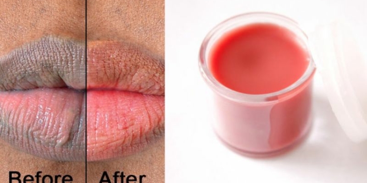 DIY - How to Make Pink Lips Cream at Home