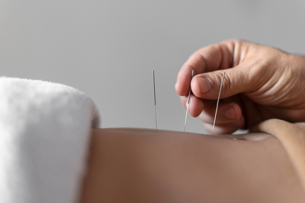 Steps to become an acupuncturist