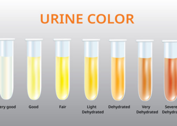 WHAT YOU SHOULD KNOW ABOUT YOUR URINE COLOR