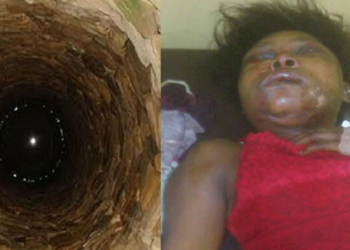 Mrs Anita Ekpeyong in hospital after rescue from a well