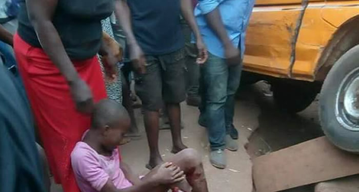 Bus crushes young girl's leg in Enugu