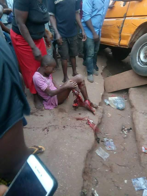 Graphic photos: Bus crushes young girl