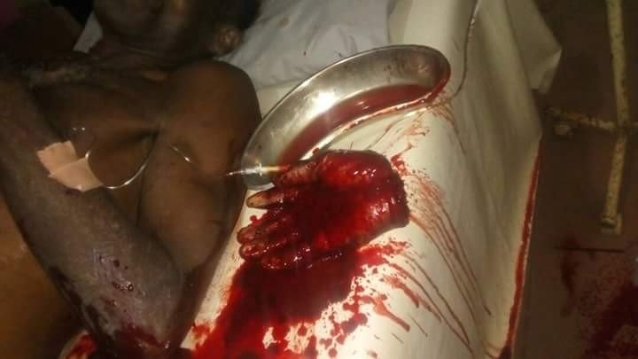Fulani Herdsmen cut off man