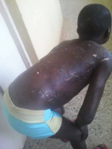 Nigerian father brutalizes son allegedly for misplacing the key to their house
