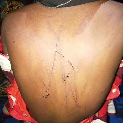 Photos: Sister to Secretary to the Adamawa State Govt allegedly brutalises her minor housemaid, had her legs chained and padlocked