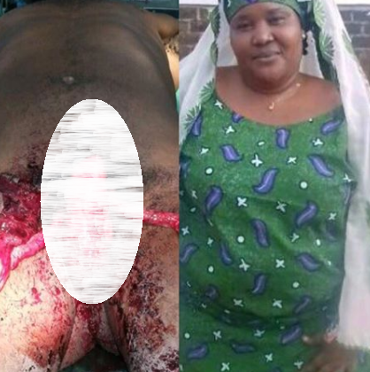 Lady pours acid on her cheating husband