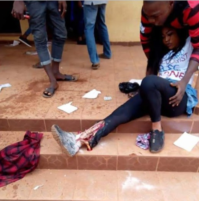 Leg of KSU graduate crushed as they were celebrating after final exam (graphic photo)
