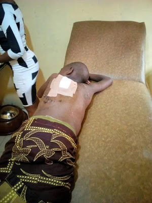 Photos: 12-year-old girl brutally flogged by her uncle in Delta State; doused with hot water then mutilated with razor blade