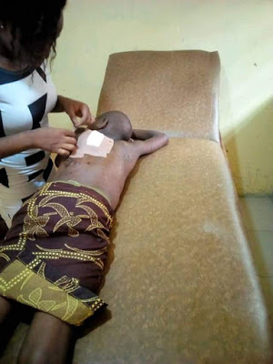 Photos: 12-year-old girl brutally flogged by her uncle in Delta State; doused with hot water then mutilated with razor blade