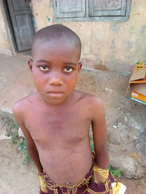Photos: 12-year-old girl brutally flogged by her uncle in Delta State; doused with hot water then mutilated with razor blade