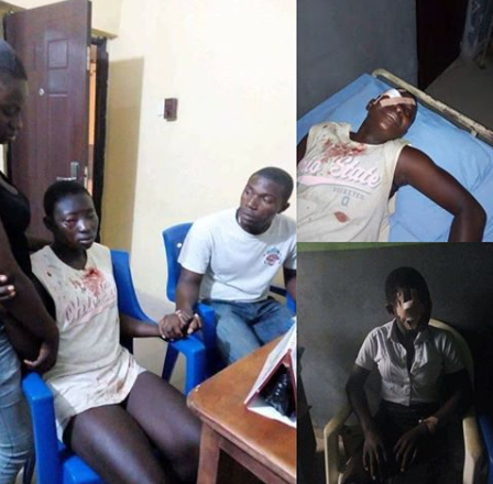 Graphic Photo: Secondary school?student stabs classmate in the eye for refusing to join cult